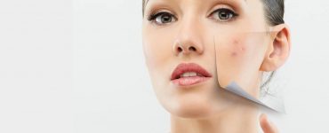 Benzamycin Krem Sivilce Sorununu Bitiriyor!